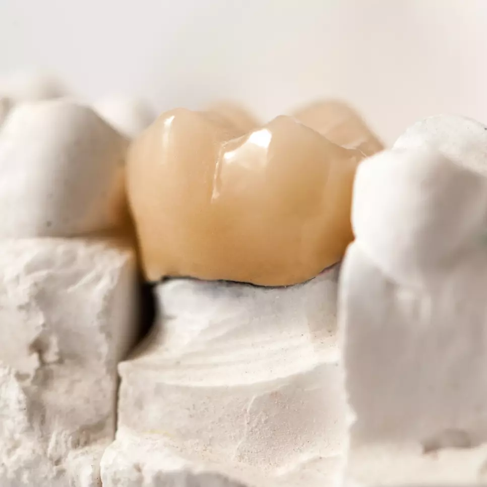 Crown on a tooth mold.